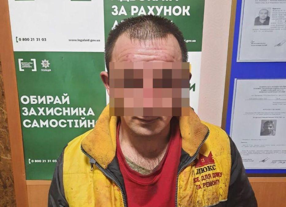Поліція затримала чоловіка, що облив хімікатами жінку та двох дітей / Нацполіція Поліція затримала чоловіка, що облив хімікатами жінку та двох дітей / Нацполіція