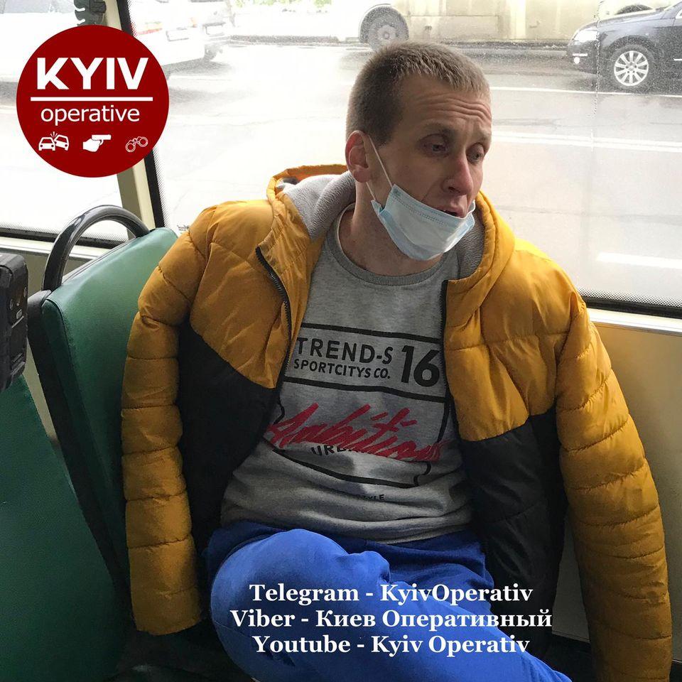 За словами водія, у нього болить зуб / Киев Оперативный Facebook За словами водія, у нього болить зуб / Киев Оперативный Facebook