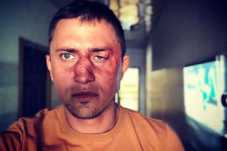 Фото актор розмістив для залучення уваги зі зйомок 2018 року \ instagram.com/bugevuge Фото актор розмістив для залучення уваги зі зйомок 2018 року \ instagram.com/bugevuge