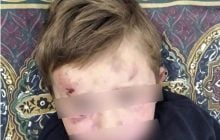 Струс мозку та перелам ноги: під Тернополем чоловік жорстоко побив свого "неслухняного" чотирилітнього пасинка (фото)