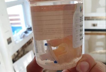 Шотландка нашла человеческое сердце в купленном доме и выиграла конкурс на самую странную находку (фото)