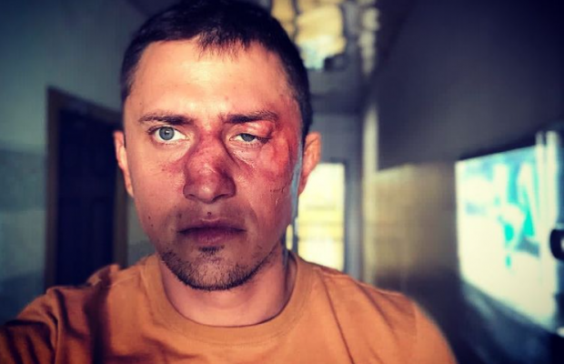 Прилучний вперше прокоментував своє побиття