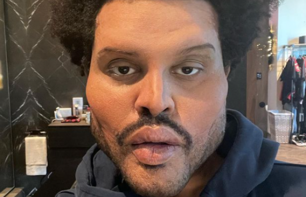 Співак The Weeknd шокував фанатів своїм обличчям