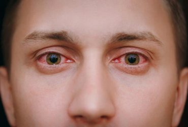Чому болять очі - причини і лікування неприємного симптому