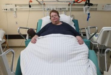 Геніталій ніхто не помітив: у США чоловікові випадково зробили кесарів розтин