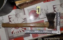 В Одесской области мужчина травмировал топором отца за отказ в сигарете (фото)