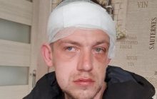Members of Romani community brutally beat Donbas war veteran in Zakarpattia (Photo)