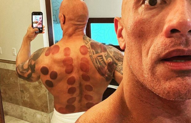 Дуейн Джонсон шокував плямами на тілі: "виглядає, наче гора пепероні" (фото)