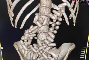 В аэропорту Борисполь задержали наркокурьера-глотателя (фото)