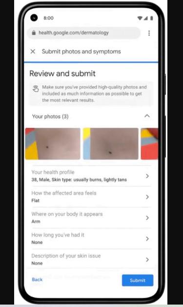 Google создал приложение для выявления заболевания кожи Google создал приложение для выявления заболевания кожи