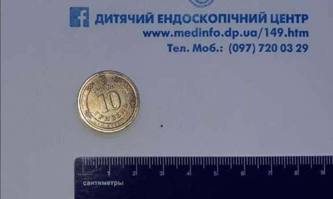 Підліток проковтнув монету / фото: Сергій Щудро Підліток проковтнув монету / фото: Сергій Щудро
