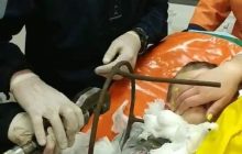 На Полтавщині 5-річний хлопчик грався у дворі та проштрикнув собі шию штирем (відео)