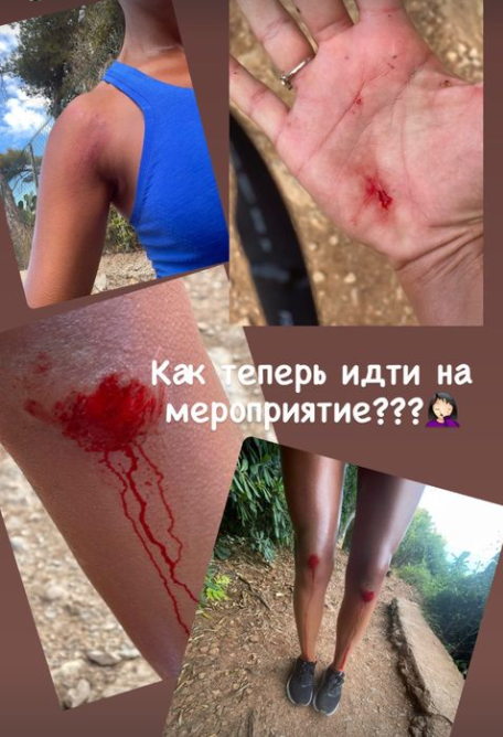 Санта Дімопулос травмувала коліна, руки і плече / фото instagram.com/santadimopulos Санта Дімопулос травмувала коліна, руки і плече / фото instagram.com/santadimopulos