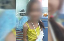 Россиянка отрезала маленькой дочери фалангу пальца за игру со спичками