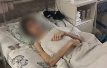 "Духовно лечил": в Одессе отец морил голодом сына-подростка