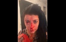 Полиция задержала двух подозреваемых в жестоком избиении правозащитницы в Днепре