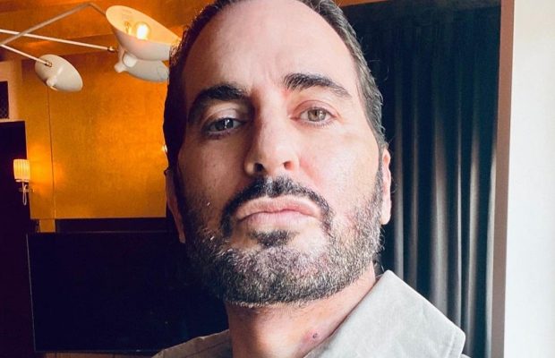 58-річний світовий дизайнер зробив пластичну операцію і показав результат