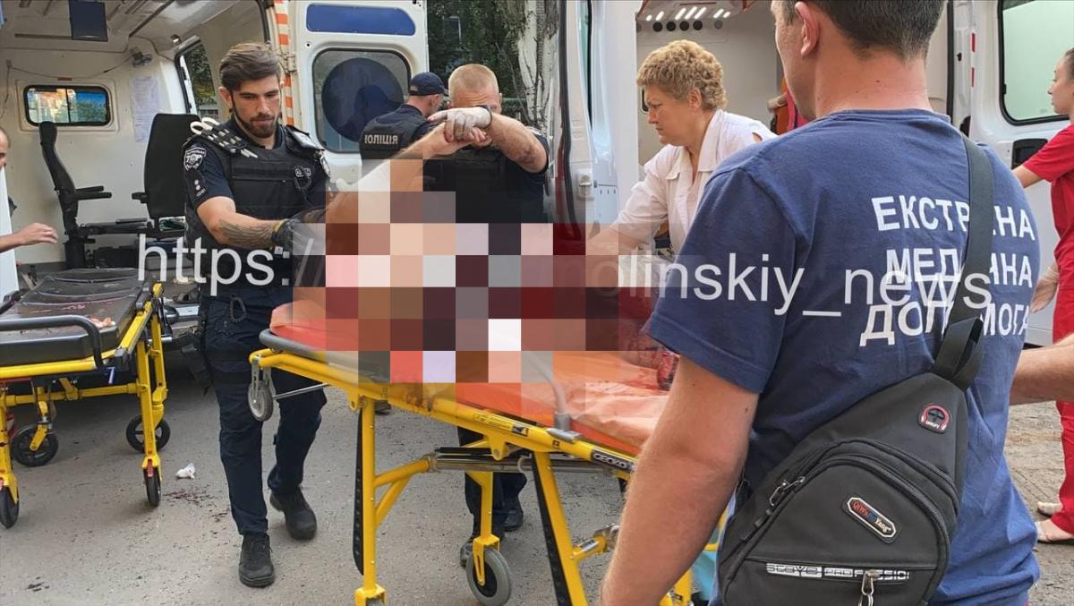 В Кривом Роге мужчина подорвал во дворе гранату, ему оторвало ногу В Кривом Роге мужчина подорвал во дворе гранату, ему оторвало ногу