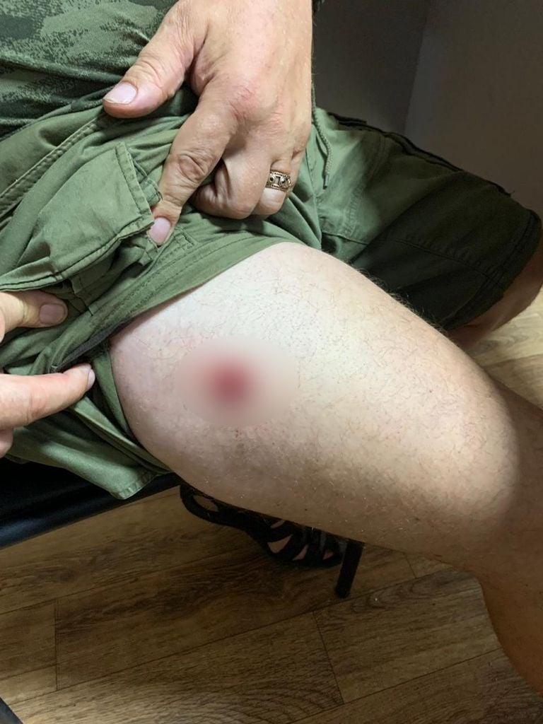 На Київщині чоловіки не поділили місце у цирку та влаштували стрілянину (фото) На Київщині чоловіки не поділили місце у цирку та влаштували стрілянину (фото)
