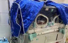 В Ужгороде уникальная операция спасла жизнь недоношенных тройняшек