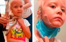 Ядовитая змея укусила 5-летнюю россиянку за щеку (фото)