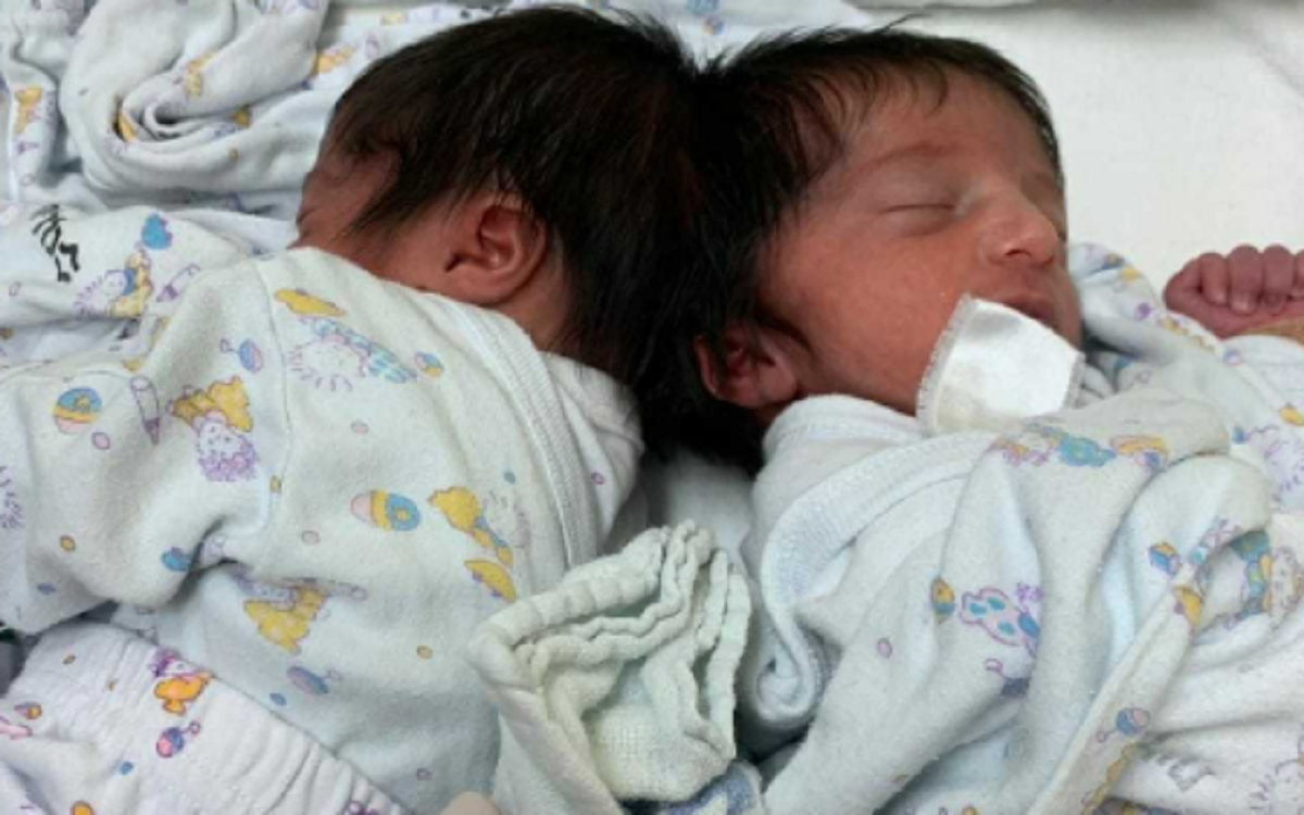 Дети родились в августе 2020-го, но операцию по их разделению медики начали планировать еще до появления малышек на свет / фото Soroka Medical Center