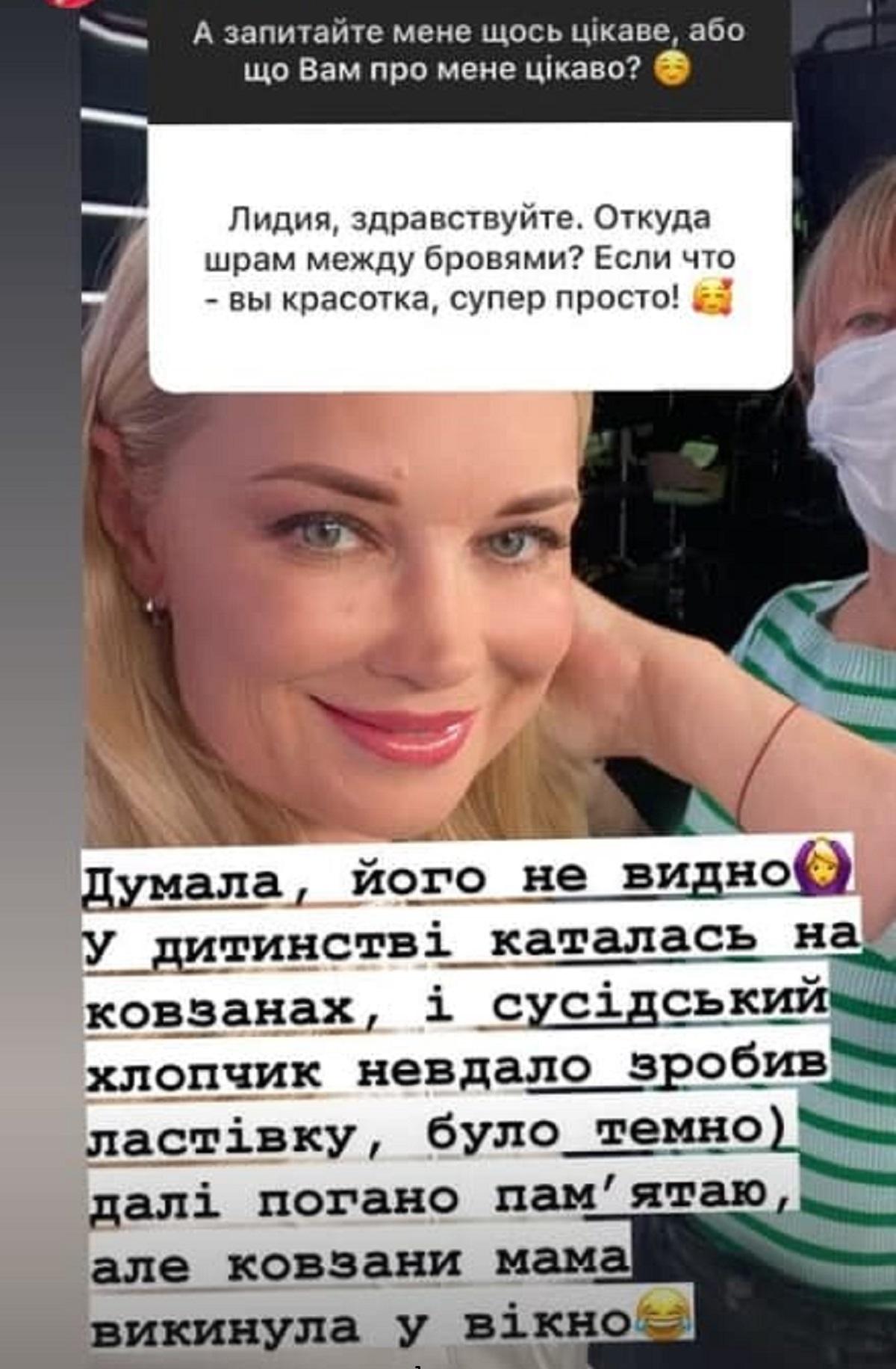 История Таран о ее шраме на лице / фото - instagram.com/lidiyataran История Таран о ее шраме на лице / фото - instagram.com/lidiyataran