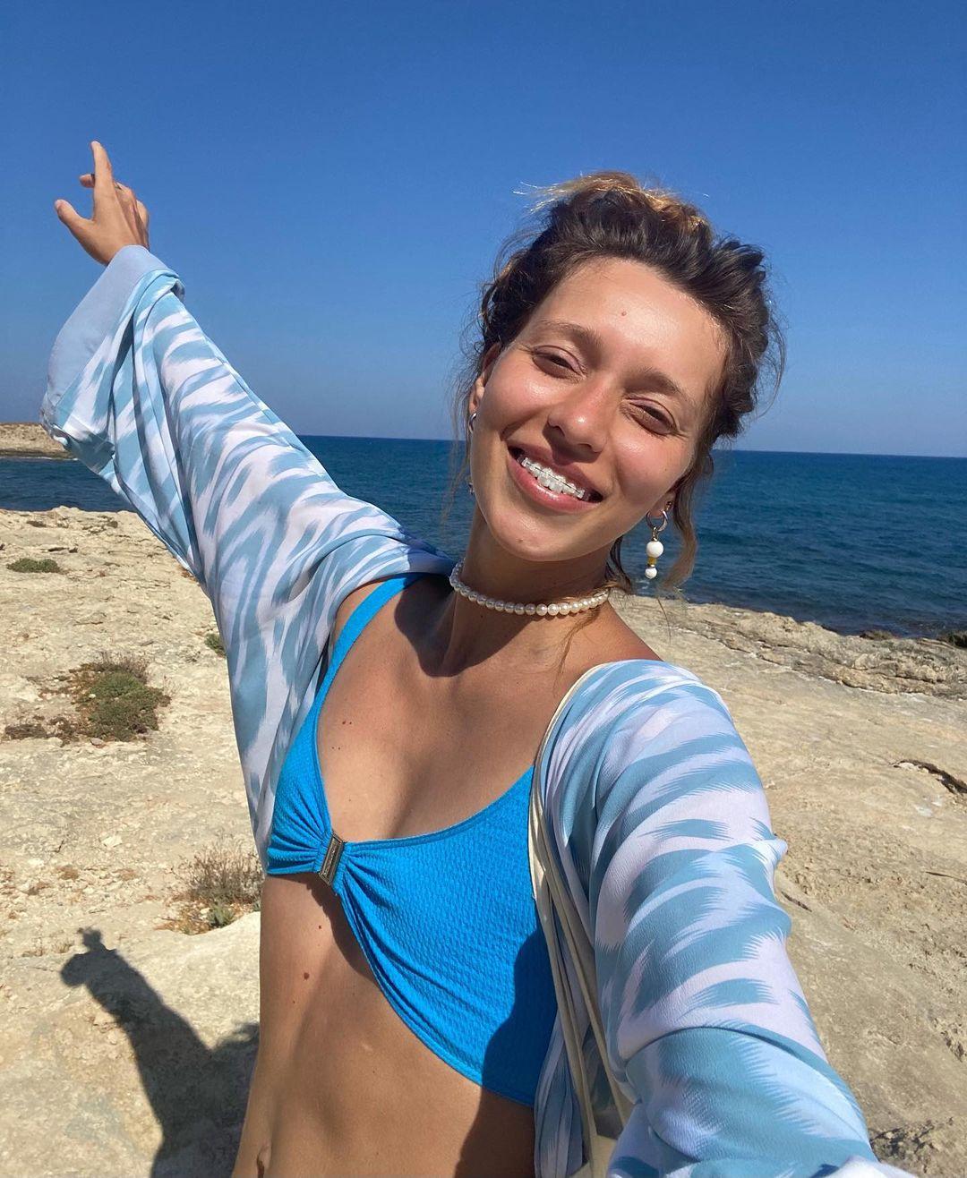 'Бесследно исчезла': Регина Тодоренко на фоне хейта призналась, делала ли операцию по уменьшению груди 'Бесследно исчезла': Регина Тодоренко на фоне хейта призналась, делала ли операцию по уменьшению груди