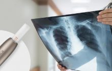 MEDWIKI. Інтерв'ю з лікарями: 10 питань про вплив IQOS на здоров'я