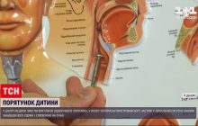 В Днепре малыш проглотил болт и едва не задохнулся (видео)