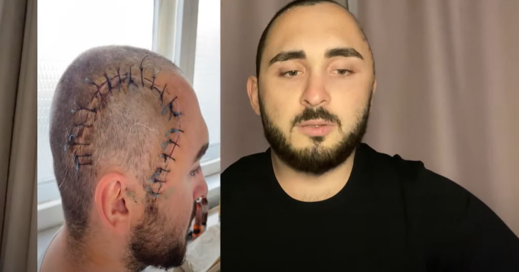 На чоловіка напали посеред вулиці \ youtube Олексій Остаповський На чоловіка напали посеред вулиці \ youtube Олексій Остаповський