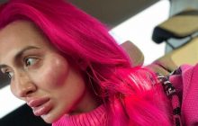 "Дуже шкода обличчя": українка з величезними вилицями показала себе без макіяжу (фото)