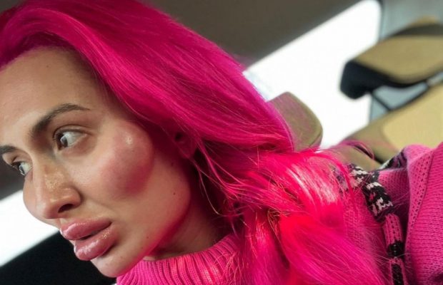 "Дуже шкода обличчя": українка з величезними вилицями показала себе без макіяжу (фото)