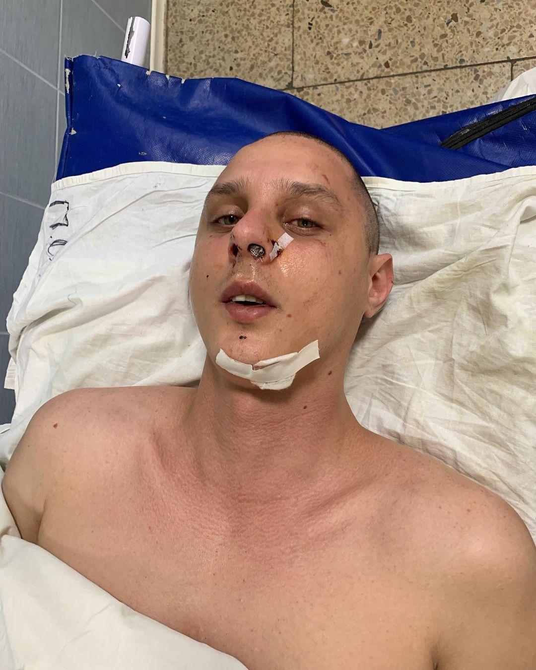 Николая Журавлева избили в подъезде / instagram.com/juniko_music