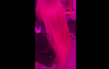 "Не хватает ботокса для мозгов": украинка с огромными скулами ужаснула сеть после новой процедуры (фото)