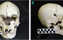 Ученые изучили 200-летний череп с необитаемого острова со следами жуткой болезни