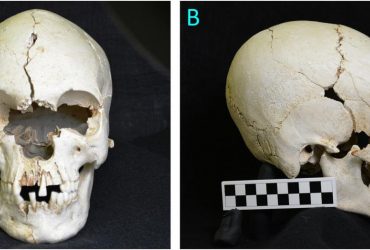 Вчені дослідили 200-річний череп з безлюдного острова зі слідами страшної хвороби