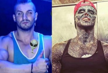 Француз мечтает стать инопланетянином: он уже отрезал себе нос, уши и пальцы (фото, видео)