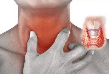 Лишний вес и проблемы щитовидной железы – прямая связь