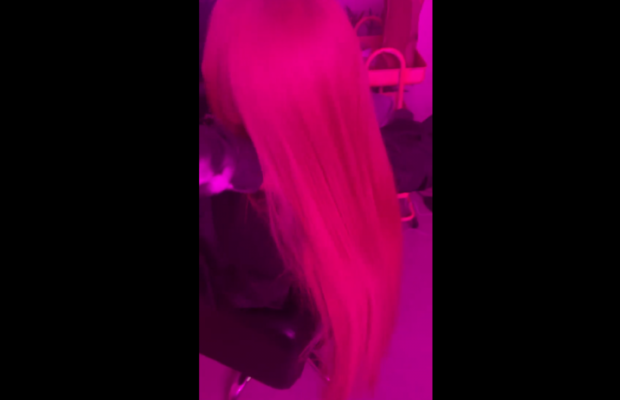 "Не вистачає ботокса для мізків": українка з величезними вилицями жахнула мережу після нової процедури (фото)