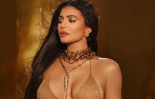 Краса не врятує світ: 5 знаменитостей з дефектами зовнішності, які ви могли не помітити (фото)