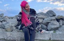 "Взагалі не впізнати": українка з найбільшими вилицями показала, як виглядала у 16 років без пластики