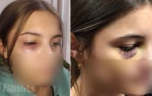 Повалил на пол и бил ногами: в Ривному семиклассник избил свою сверстницу (фото)