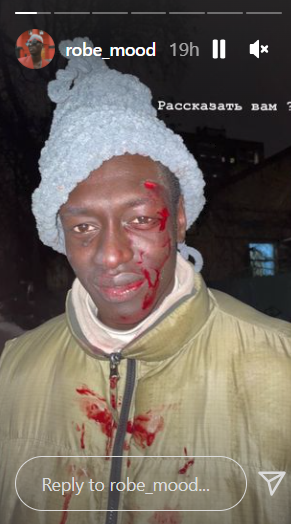 Темношкірий хлопець поскаржився, що в Києві його по обличчю вдарив таксист / фото instagram.com/robe_mood