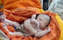 В Індії народився малюк з чотирма руками та ногами: місцеві вважають його божеством (фото)