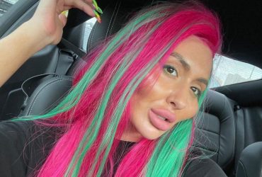 Обладательница самых больших скул Покрещук надула очередную часть тела (фото)