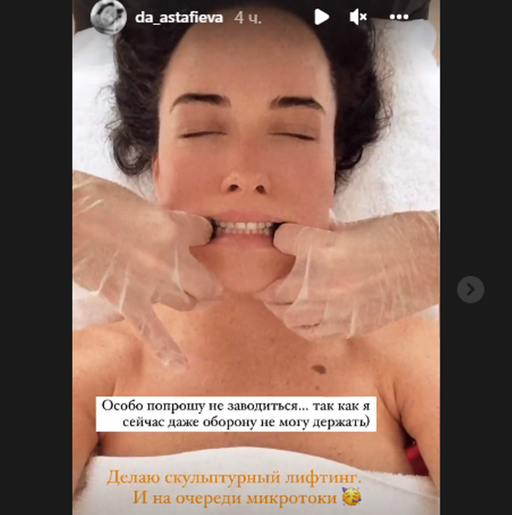 Астафьева сделала скульптурный лифтинг лица / скриншот