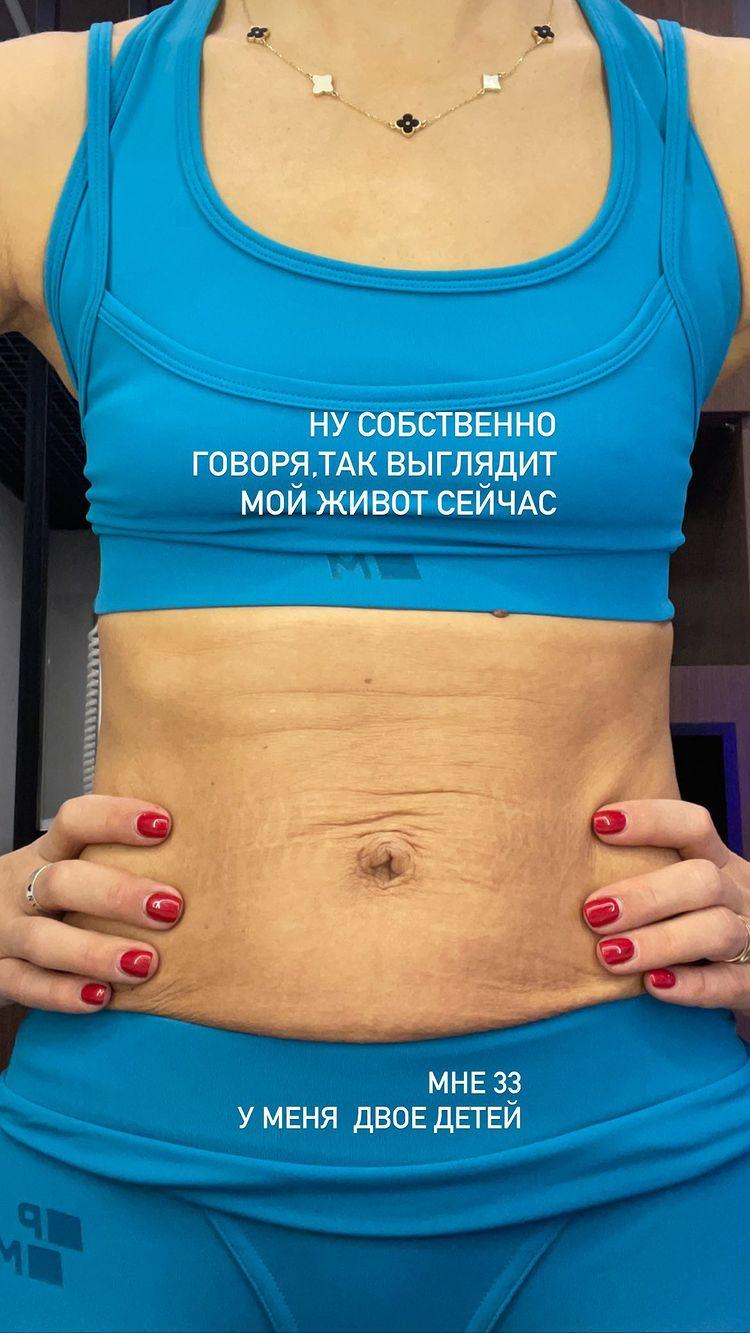 Ілона Гвоздьова показала себе без фільтрів / instagram.com/ilonagvozdeva