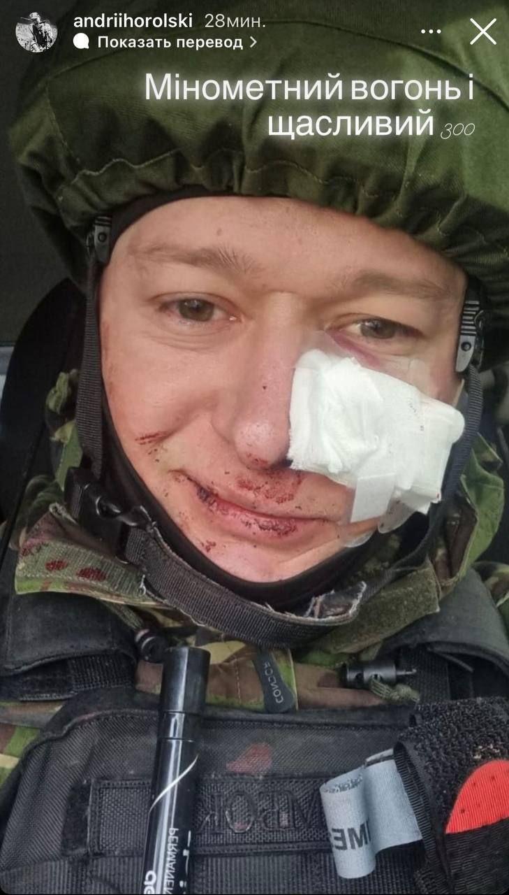 Андрей Хлывнюк получил ранение / Фото - instagram.com/andriihorolski/ Андрей Хлывнюк получил ранение / Фото - instagram.com/andriihorolski/
