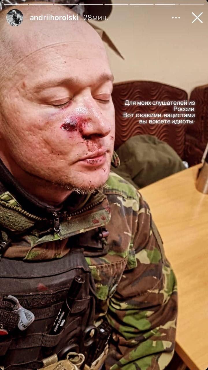 Андрей Хлывнюк получил ранение / Фото - instagram.com/andriihorolski/ Андрей Хлывнюк получил ранение / Фото - instagram.com/andriihorolski/